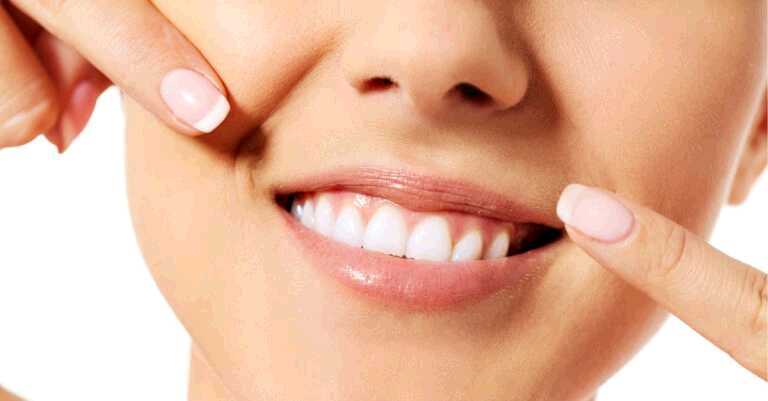 How Diabetes Affects Your Oral Health (+5 Ways to Prevent It!)