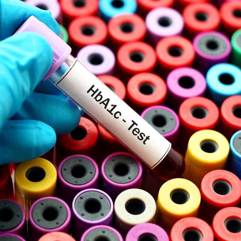 Diabetes & Glycemia Control – What Your HbA1c Test Means