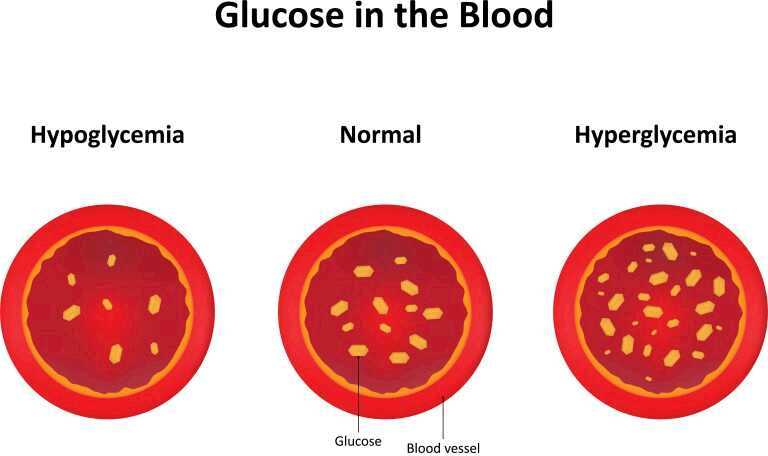 Hypoglycemia vs. Diabetes – How to Know the Difference