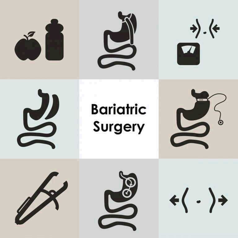 3 Reasons to Consider Bariatric Surgery to Treat Diabetes