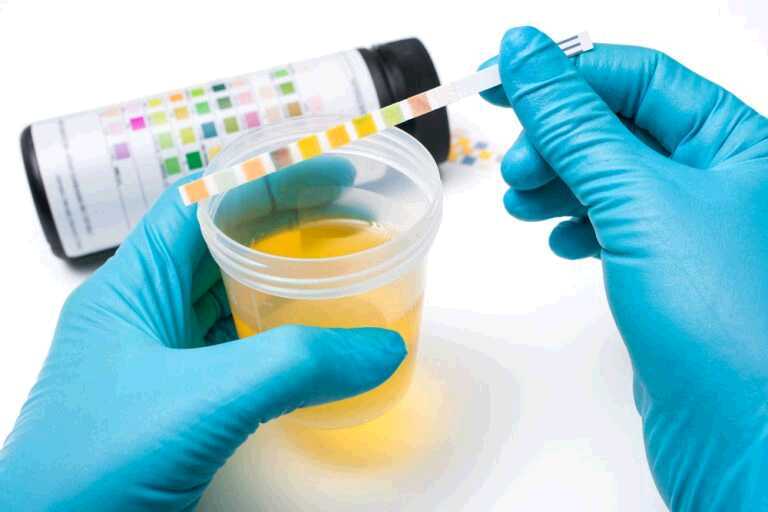 8 Ways You Can Prepare for Diabetes Urine Test