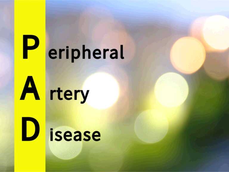 Your Treatment Options for Peripheral Arterial Disease